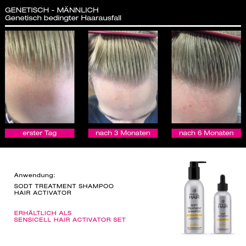 SensiCell Hair – Hair Activator SET