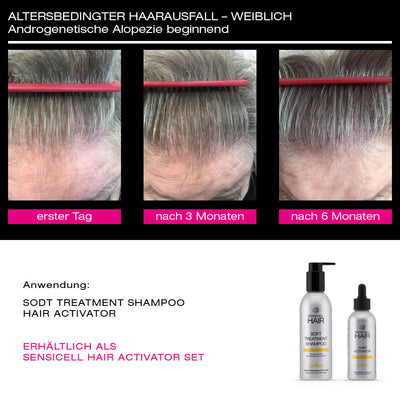 Sencicell Hair - Soft Treatment Shampoo