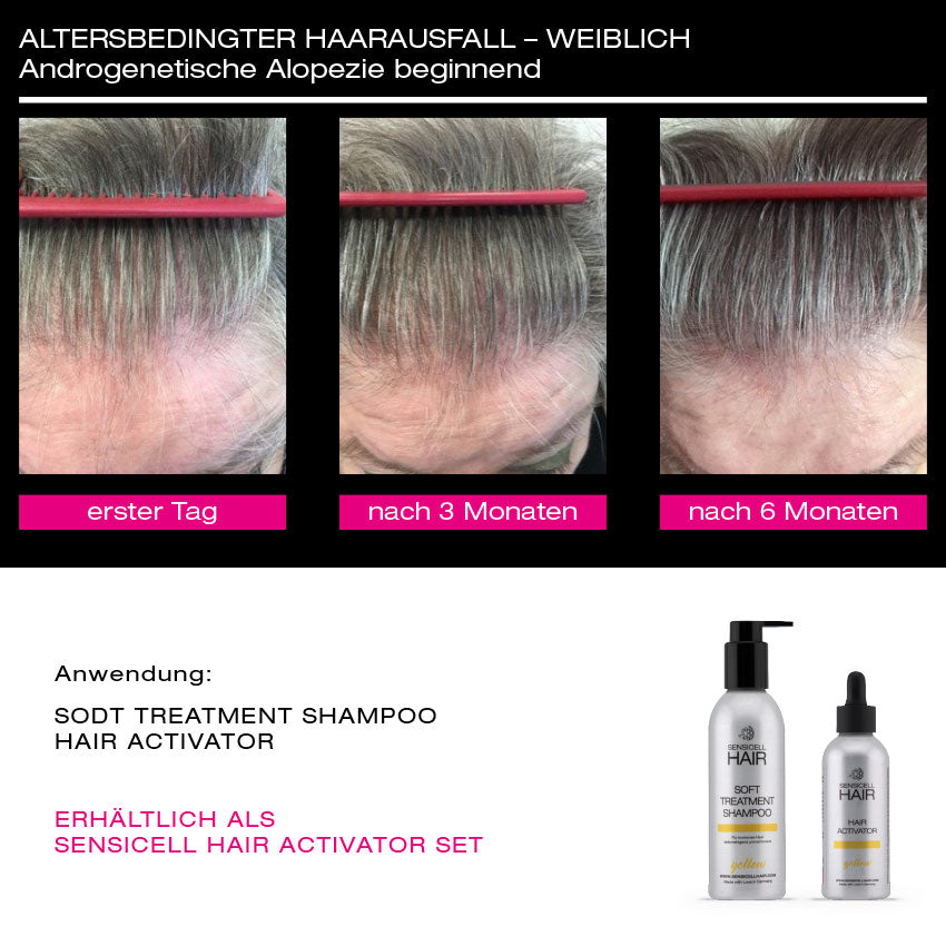 Sensicell Hair Activator