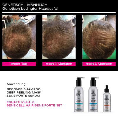 SensiCell Hair – Deep Peeling Mask